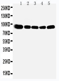 Anti-OSBP1 antibody, PA1949, Western blotting
Lane 1: Rat Kidney Tissue Lysate
Lane 2: Rat Spleen Tissue Lysate
Lane 3: Rat Lung Tissue Lysate
Lane 4: HELA Cell Lysate
Lane 5: A549 Cell Lysate