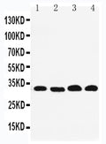 Anti-REA antibody, PA1951, Western blotting
Lane 1: PANC Cell Lysate
Lane 2: COLO320 Cell Lysate
Lane 3: U87Cell Lysate
Lane 4: HEPA Cell Lysate