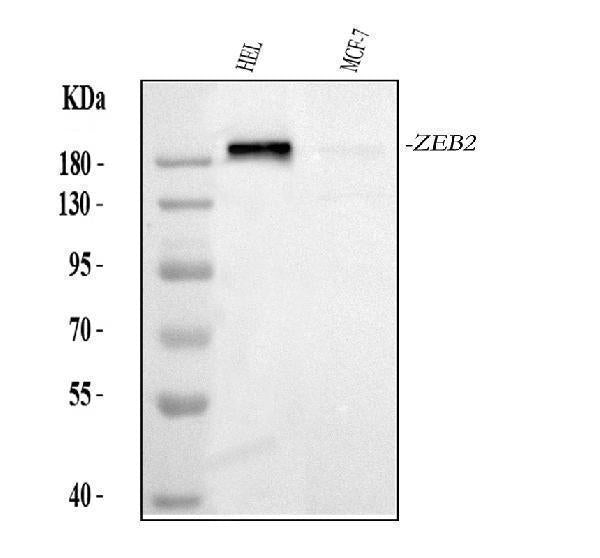 Anti-Smad Interacting Protein 1/ZEB2 Antibody Picoband®