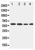 Anti-LCAT antibody, PA1967, Western blotting
Lane 1: Rat Brain Tissue Lysate
Lane 2: U87 Cell Lysate
Lane 3: HELA Cell Lysate
Lane 4: SMMC Cell Lysate