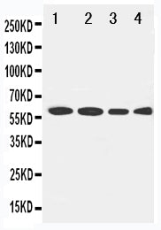 Anti-LCAT antibody, PA1967, Western blotting
Lane 1: Rat Brain Tissue Lysate
Lane 2: U87 Cell Lysate
Lane 3: HELA Cell Lysate
Lane 4: SMMC Cell Lysate