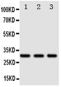 Anti-DR4 antibody, PA1975, Western blotting
Lane 1: SW620 Cell Lysate
Lane 2: COLO320 Cell Lysate
Lane 3: HT1080 Cell Lysate