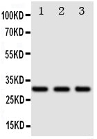 Anti-DR4 antibody, PA1975, Western blotting
Lane 1: SW620 Cell Lysate
Lane 2: COLO320 Cell Lysate
Lane 3: HT1080 Cell Lysate