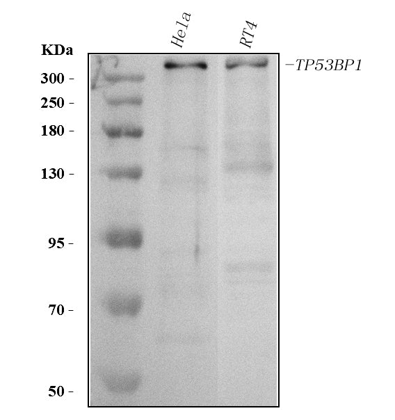 Anti-53BP1/TP53BP1 Antibody Picoband®