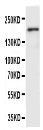 Anti-VEGF Receptor 2 antibody, PA1989, Western blotting
WB: SMMC Cell Lysate