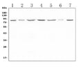 Anti-LTK Antibody Picoband®