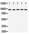 Anti-TrkC antibody, PA1992-1, Western blotting
Lane 1: Rat Brain Tissue Lysate
Lane 2: Mouse Brain Tissue Lysate
Lane 3: U87 Cell Lysate
Lane 4: SHG Cell Lysate
Lane 5: NEURO Cell Lysate