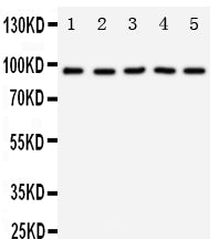 Anti-TrkC antibody, PA1992-1, Western blotting
Lane 1: Rat Brain Tissue Lysate
Lane 2: Mouse Brain Tissue Lysate
Lane 3: U87 Cell Lysate
Lane 4: SHG Cell Lysate
Lane 5: NEURO Cell Lysate