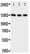 Anti-TrkC antibody, PA1992, Western blotting
Lane 1: Rat Brain Tissue Lysate
Lane 2: Mouse Brain Tissue Lysate
Lane 3: U87 Cell Lysate