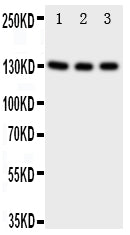 Anti-TrkC antibody, PA1992, Western blotting
Lane 1: Rat Brain Tissue Lysate
Lane 2: Mouse Brain Tissue Lysate
Lane 3: U87 Cell Lysate