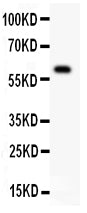 Anti-DR3 antibody, PA2004, Western blotting
All lanes: Anti DR3 (PA2004) at 0.5ug/ml
WB: COLO320 Whole Cell Lysate at 40ug
Predicted bind size: 59KD
Observed bind size: 59KD