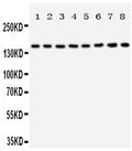 Anti-Hamartin antibody, PA2012, Western blotting
All lanes: Anti Hamartin (PA2012) at 0.5ug/ml
Lane 1: Rat Skeletal Muscle Tissue Lysate at 50ug
Lane 2: Rat Heart Tissue Lysate at 50ug
Lane 3: Rat Brain Tissue Lysate at 50ug
Lane 4: Rat Lung Tissue Lysate at 50ug
Lane 5: 293T Whole Cell Lysate at 40ug
Lane 6: HELA Whole Cell Lysate at 40ug
Lane 7: HT1080 Whole Cell Lysate at 40ug
Lane 8: SMMC Whole Cell Lysate at 40ug
Predicted bind size: 130KD
Observed bind size: 160KD