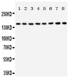 Anti-Hamartin antibody, PA2012, Western blotting
All lanes: Anti Hamartin (PA2012) at 0.5ug/ml
Lane 1: Rat Skeletal Muscle Tissue Lysate at 50ug
Lane 2: Rat Heart Tissue Lysate at 50ug
Lane 3: Rat Brain Tissue Lysate at 50ug
Lane 4: Rat Lung Tissue Lysate at 50ug
Lane 5: 293T Whole Cell Lysate at 40ug
Lane 6: HELA Whole Cell Lysate at 40ug
Lane 7: HT1080 Whole Cell Lysate at 40ug
Lane 8: SMMC Whole Cell Lysate at 40ug
Predicted bind size: 130KD
Observed bind size: 160KD