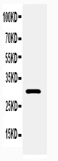 Anti-Adiponectin antibody, PA2014-1, Western blotting
WB: Rat Heart Tissue Lysate