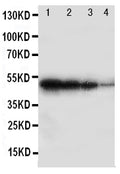 Anti-BMPR1B antibody, PA2017, Western blotting
Recombinant Protein Detection Source: E.coli derived -recombinant Human BMPR1B, 49.0KD
(162aa tag+D17-D289)
Lane 1: Recombinant Human BMPR1B Protein 10ng

Lane 2: Recombinant Human BMPR1B Protein 5ng

Lane 3: Recombinant Human BMPR1B Protein 2.5ng

Lane 4: Recombinant Human BMPR1B Protein 1.25ng