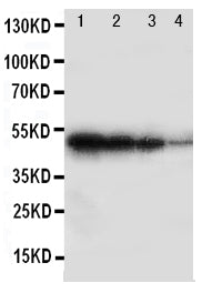 Anti-BMPR1B antibody, PA2017, Western blotting
Recombinant Protein Detection Source: E.coli derived -recombinant Human BMPR1B, 49.0KD
(162aa tag+D17-D289)
Lane 1: Recombinant Human BMPR1B Protein 10ng

Lane 2: Recombinant Human BMPR1B Protein 5ng

Lane 3: Recombinant Human BMPR1B Protein 2.5ng

Lane 4: Recombinant Human BMPR1B Protein 1.25ng