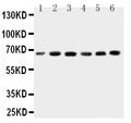 Anti-CETP antibody, PA2019, Western blotting
Lane 1: HELA Cell Lysate
Lane 2: COLO320 Cell Lysate
Lane 3: HT1080 Cell Lysate
Lane 4: JURKAT Cell Lysate
Lane 5: RAJI Cell Lysate
Lane 6: MCF-7 Cell Lysate