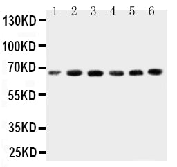 Anti-CETP antibody, PA2019, Western blotting
Lane 1: HELA Cell Lysate
Lane 2: COLO320 Cell Lysate
Lane 3: HT1080 Cell Lysate
Lane 4: JURKAT Cell Lysate
Lane 5: RAJI Cell Lysate
Lane 6: MCF-7 Cell Lysate