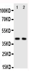 Anti-CXCR5 antibody, PA2021, Western blotting
Lane 1: Rat Spleen Tissue Lysate
Lane 2: HELA Cell Lysate