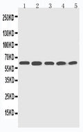 Anti-CYP2U1 antibody, PA2022, Western blotting
Lane 1: HELA Cell Lysate
Lane 2: MCF-7 Cell Lysate
Lane 3: MM453 Cell Lysate
Lane 4: COLO320 Cell Lysate
Lane 5: HT1080 Cell Lysate