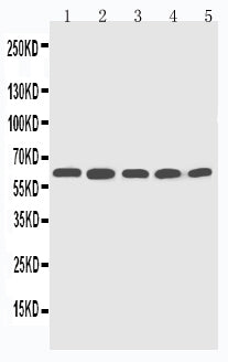 Anti-CYP2U1 antibody, PA2022, Western blotting
Lane 1: HELA Cell Lysate
Lane 2: MCF-7 Cell Lysate
Lane 3: MM453 Cell Lysate
Lane 4: COLO320 Cell Lysate
Lane 5: HT1080 Cell Lysate
