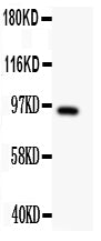 Anti-DISC1 Antibody Picoband®
