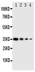 Anti-GCN2 antibody, PA2028, Western blotting
Recombinant Protein Detection Source: E.coli derived -recombinant Mouse EIF2AK4, 35.3KD
(162aa tag+ E801-R954)
Lane 1: Recombinant Mouse EIF2AK4 Protein 10ng

Lane 2: Recombinant Mouse EIF2AK4 Protein 5ng

Lane 3: Recombinant Mouse EIF2AK4 Protein 2.5ng
Lane 4: Recombinant Mouse EIF2AK4 Protein 1.25ng
