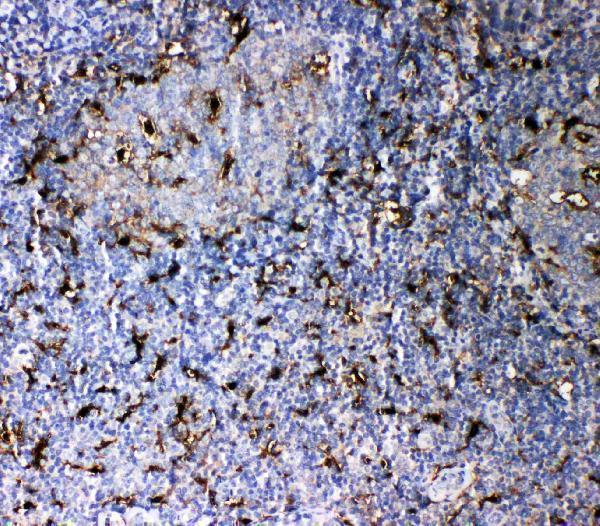 Anti-IL-18 antibody, PA2037, IHC(P)
IHC(P): Human Tonsil Tissue