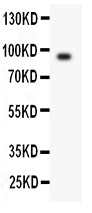 Anti-Periostin antibody, PA2048, Western blotting
All lanes: Anti Periostin (PA2048) at 0.5ug/ml
WB: Mouse Cardiac Muscle Tissue Lysate at 50ug
Predicted bind size: 93KD
Observed bind size: 93KD