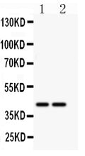 Anti-CD244 antibody, PA2057, Western blotting
All lanes: Anti CD244 (PA2057) at 0.5ug/ml
Lane 1: MCF-7 Whole Cell Lysate at 40ug
Lane 2: HELA Whole Cell Lysate at 40ug
Predicted bind size: 42KD
Observed bind size: 42KD