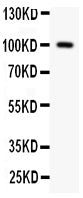 Anti-F2 antibody, PA2059, Western blotting
All lanes: Anti F2 (PA2059) at 0.5ug/ml
WB : Rat Testis Tissue Lysate at 50ug
Predicted bind size: 70KD
Observed bind size: 100KD