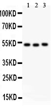 Anti-Factor VII  antibody, PA2060, Western blotting
All lanes: Anti Factor VII (PA2060) at 0.5ug/ml
Lane 1: SMMC Whole Cell Lysate at 40ug
Lane 2: JURKAT Whole Cell Lysate at 40ug
Lane 3: RAJI Whole Cell Lysate at 40ug
Predicted bind size: 52KD
Observed bind size: 52KD