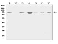 Anti-Factor VIII/F8 Antibody Picoband®
