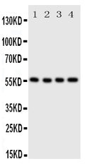 Anti-SLC2A5 antibody, PA2064, Western blotting
Lane 1: U87 Cell Lysate
Lane 2: 293T Cell Lysate
Lane 3: HT1080 Cell Lysate
Lane 4: SW620 Cell Lysate