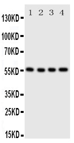 Anti-SLC2A5 antibody, PA2064, Western blotting
Lane 1: U87 Cell Lysate
Lane 2: 293T Cell Lysate
Lane 3: HT1080 Cell Lysate
Lane 4: SW620 Cell Lysate