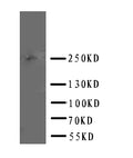Anti-ABCA4 antibody, PA2065, Western blotting
WB: U87 Cell Lysate