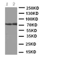 Anti-ABCG4 antibody, PA2067, Western blotting
Lane 1: Rat Brain Tissue Lysate
Lane 2: Mouse Brain Tissue Lysate