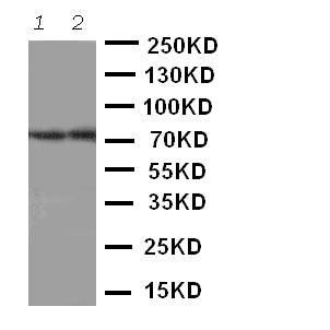 Anti-ABCG4 antibody, PA2067, Western blotting
Lane 1: Rat Brain Tissue Lysate
Lane 2: Mouse Brain Tissue Lysate