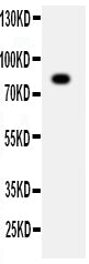 Anti-ADAM2 antibody, PA2069, Western blotting
WB: SMMC Cell Lysate