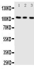 Anti-ADAMTS1 antibody, PA2071, Western blotting
All lanes: Anti ADAMTS1 (PA2071) at 0.5ug/ml

Lane 1: Rat Liver Tissue Lysate at 50ug

Lane 2: Rat Heart Tissue Lysate at 50ug

Lane 3: Rat Brain Tissue Lysate at 50ug

Predicted bind size: 105KD

Observed bind size: 105KD