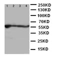 Anti-ALDH2 Antibody Picoband®