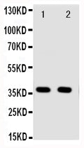 Anti-Annexin A10 antibody, PA2077, Western blotting
Lane 1: A549 Cell Lysate
Lane 2: A549 Cell Lysate