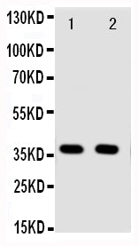 Anti-Annexin A10 antibody, PA2077, Western blotting
Lane 1: A549 Cell Lysate
Lane 2: A549 Cell Lysate