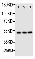 Anti-CXCR4 antibody, PA2081, Western blotting
Lane 1: M231 Cell Lysate
Lane 2: MCF-7 Cell Lysate
Lane 3: JURKAT Cell Lysate