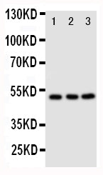 Anti-CXCR4 antibody, PA2081, Western blotting
Lane 1: M231 Cell Lysate
Lane 2: MCF-7 Cell Lysate
Lane 3: JURKAT Cell Lysate