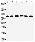 Anti-PC1/3/PCSK1 Antibody Picoband®