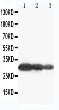 Anti-Aquaporin 6 antibody, PA2092, Western blotting
Lane 1: U87 Cell Lysate
Lane 2: COLO320 Cell Lysate
Lane 3: MCF-7 Cell Lysate