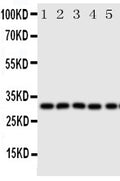 Anti-Aquaporin 9 antibody, PA2094, Western blotting
All lanes: Anti Aquaporin 9 (PA2094) at 0.5ug/ml

Lane 1: Mouse Liver Tissue Lysate at 50ug

Lane 2: Mouse Lung Tissue Lysate at 50ug

Lane 3: Mouse Spleen Tissue Lysate at 50ug

Lane 4: Mouse Testis Tissue Lysate at 50ug

Lane 5: PC-12 Whole Cell Lysate at 40ug

Predicted bind size: 31KD

Observed bind size: 31KD