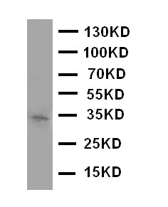 Anti-Aquaporin 10 antibody, PA2095, Western blotting
WB: COLO320 Cell Lysate