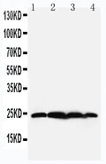 Anti-BAG2 antibody, PA2099, Western blotting
Lane 1: Rat Testis Tissue Lysate
Lane 2: HELA Cell Lysate
Lane 3: A549 Cell Lysate
Lane 4: A431 Cell Lysate